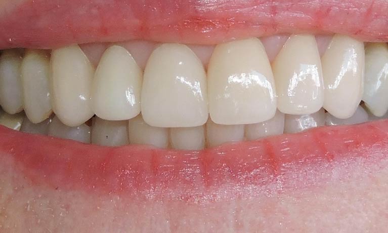 Dental Masterpiece 2