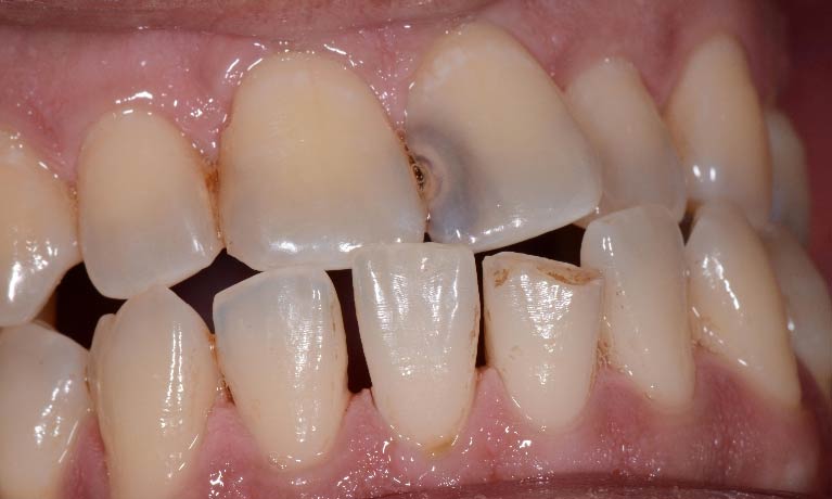 Healthy Beautiful Teeth 1