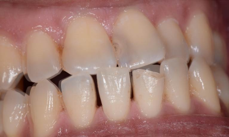 Healthy Beautiful Teeth 2