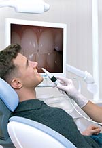 Intra Oral Camera Usage